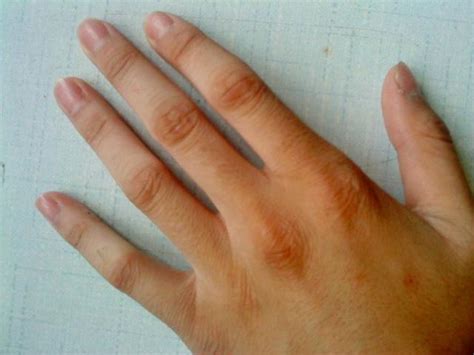 手指關節紋